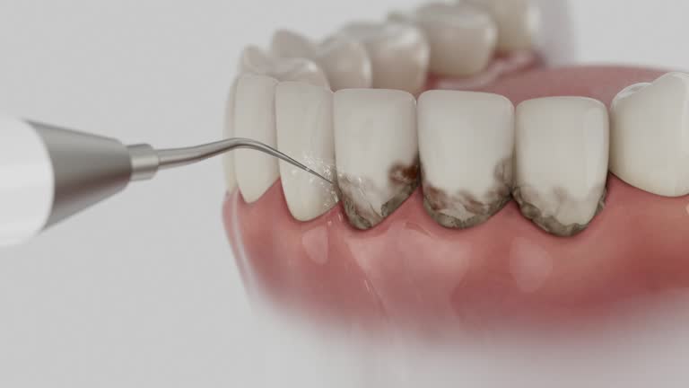 Reliable Dental Implants contractor in Byron, CA by Smile Center Dentistry